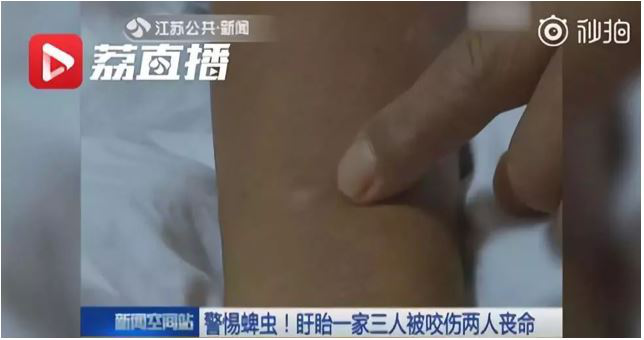 中山市民注意蜱蟲叮咬！請做好這些預防措施